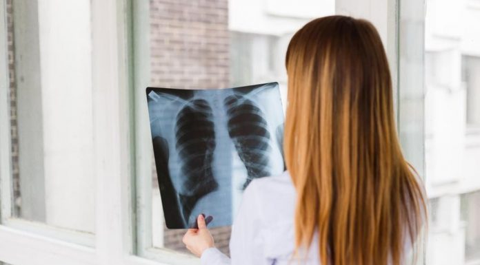 DR DAVORIN RADOVANOVIĆ O RAKU PLUĆA: OVIH 5 SIMPTOMA ZAHTEVAJU HITAN ODLAZAK LEKARU