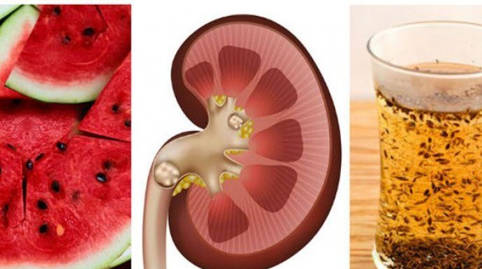 Čuli ste da su KOŠPICE LUBENICE zdrave, ali OVO vam nisu rekli: Više ih nikada nećete baciti!