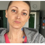 25