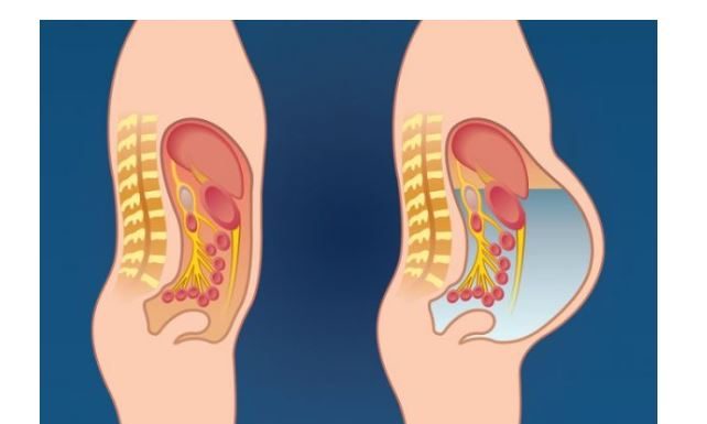 Ovo povrće može izazvati nadutost i plinove: izbjegavajte ovu namirnicu ako želite ravan trbuh