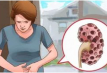 KADA SA BUBREZIMA NIJE SVE UREDU TIJELO ŠALJE OVE SIGNALE